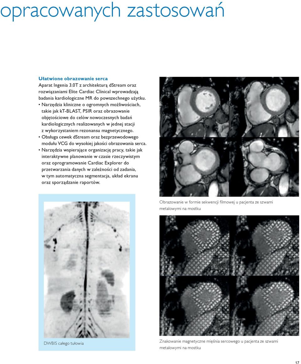 rezonansu magnetycznego. Obsługa cewek dstream oraz bezprzewodowego modułu VCG do wysokiej jakości obrazowania serca.
