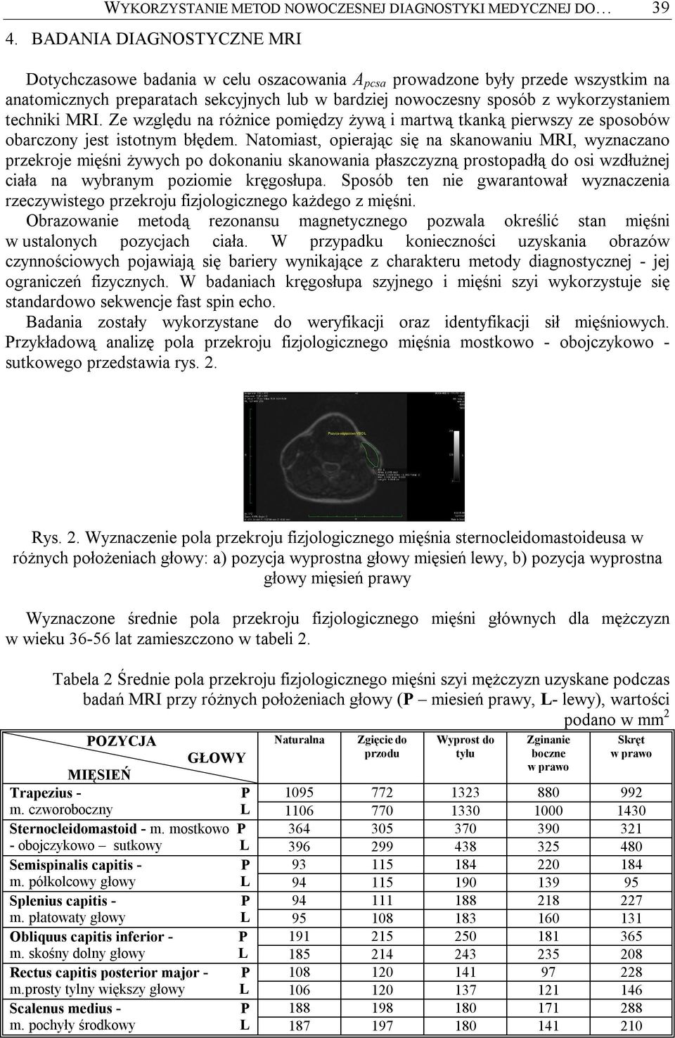 techniki RI. Ze względu na różnice pomiędzy żywą i martwą tkanką pierwszy ze sposobów obarczony jest istotnym błędem.