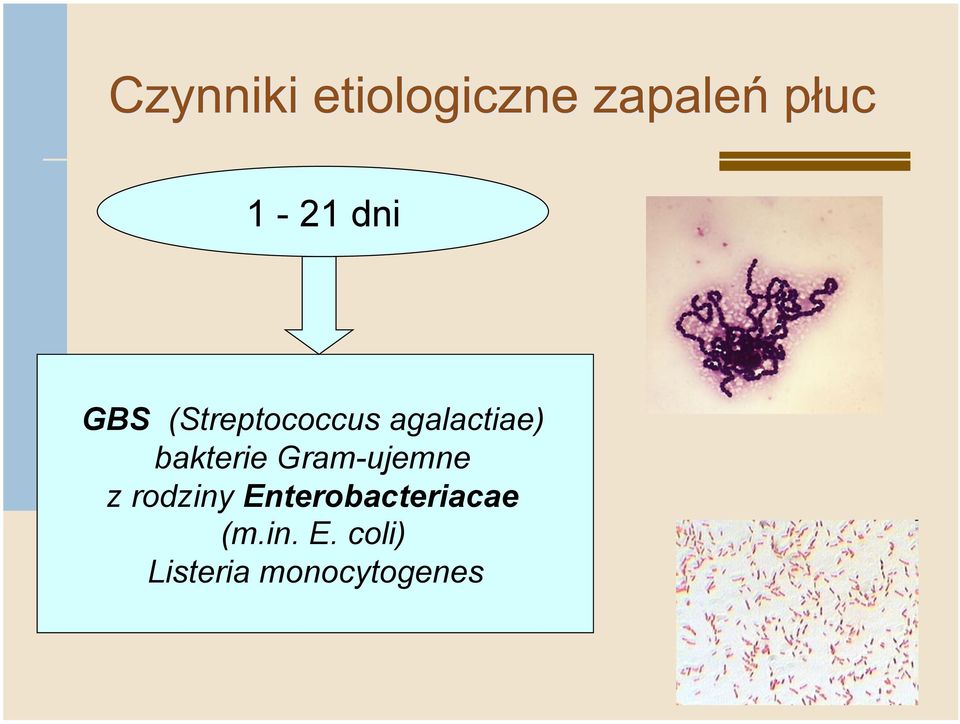 Gram-ujemne z rodziny