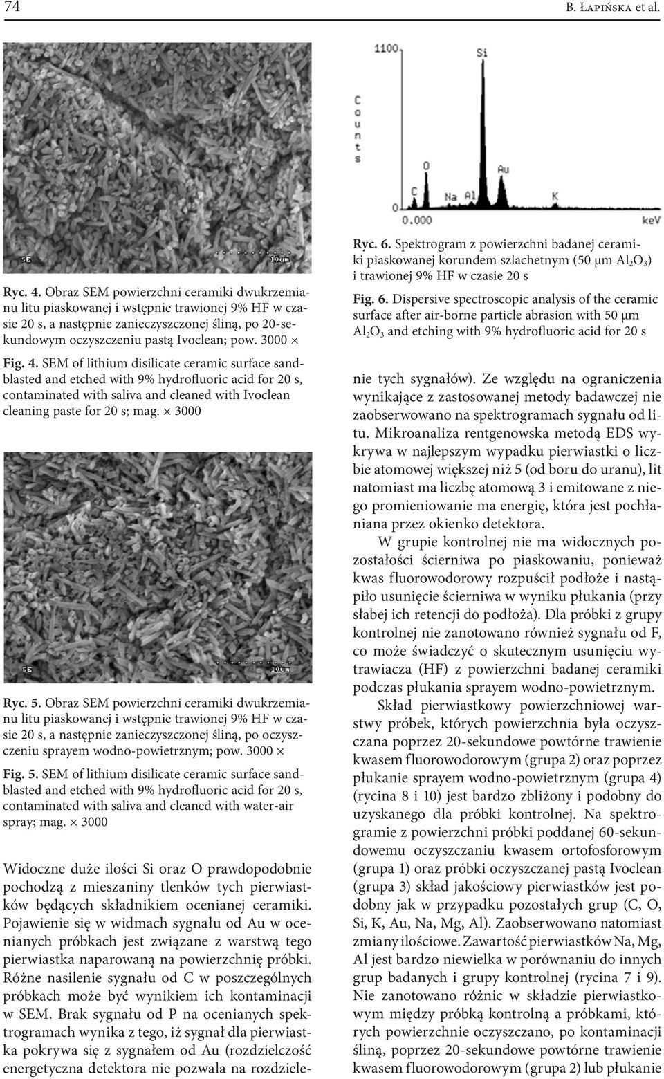 4. SEM of lithium disilicate ceramic surface sandblasted contaminated with saliva and cleaned with Ivoclean cleaning paste for 20 s; mag. 3000 Ryc. 5.