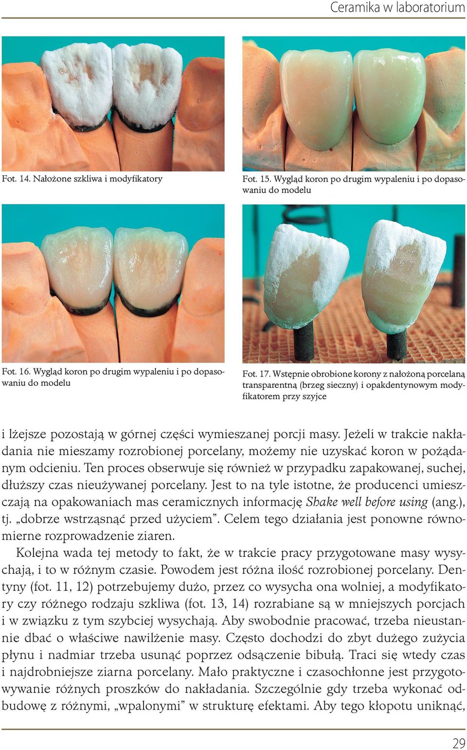 Wstępnie obrobione korony z nałożoną porcelaną transparentną (brzeg sieczny) i opakdentynowym modyﬁkatorem przy szyjce i lżejsze pozostają w górnej części wymieszanej porcji masy.