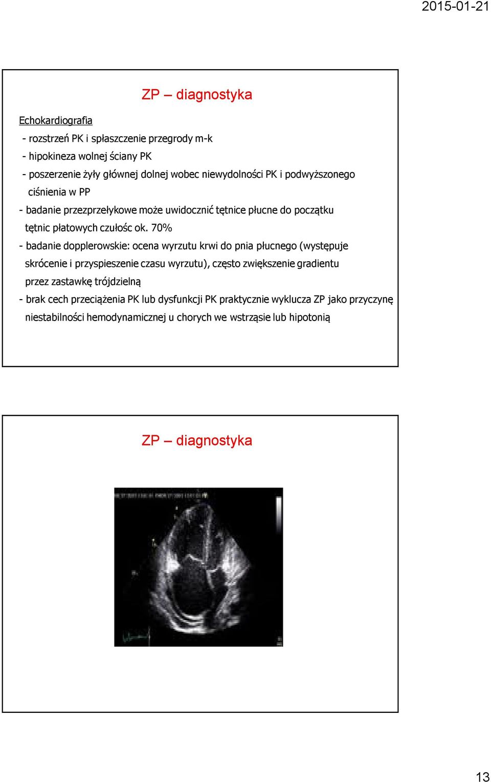 70% - badanie dopplerowskie: ocena wyrzutu krwi do pnia płucnego (występuje skrócenie i przyspieszenie czasu wyrzutu), często zwiększenie gradientu przez zastawkę