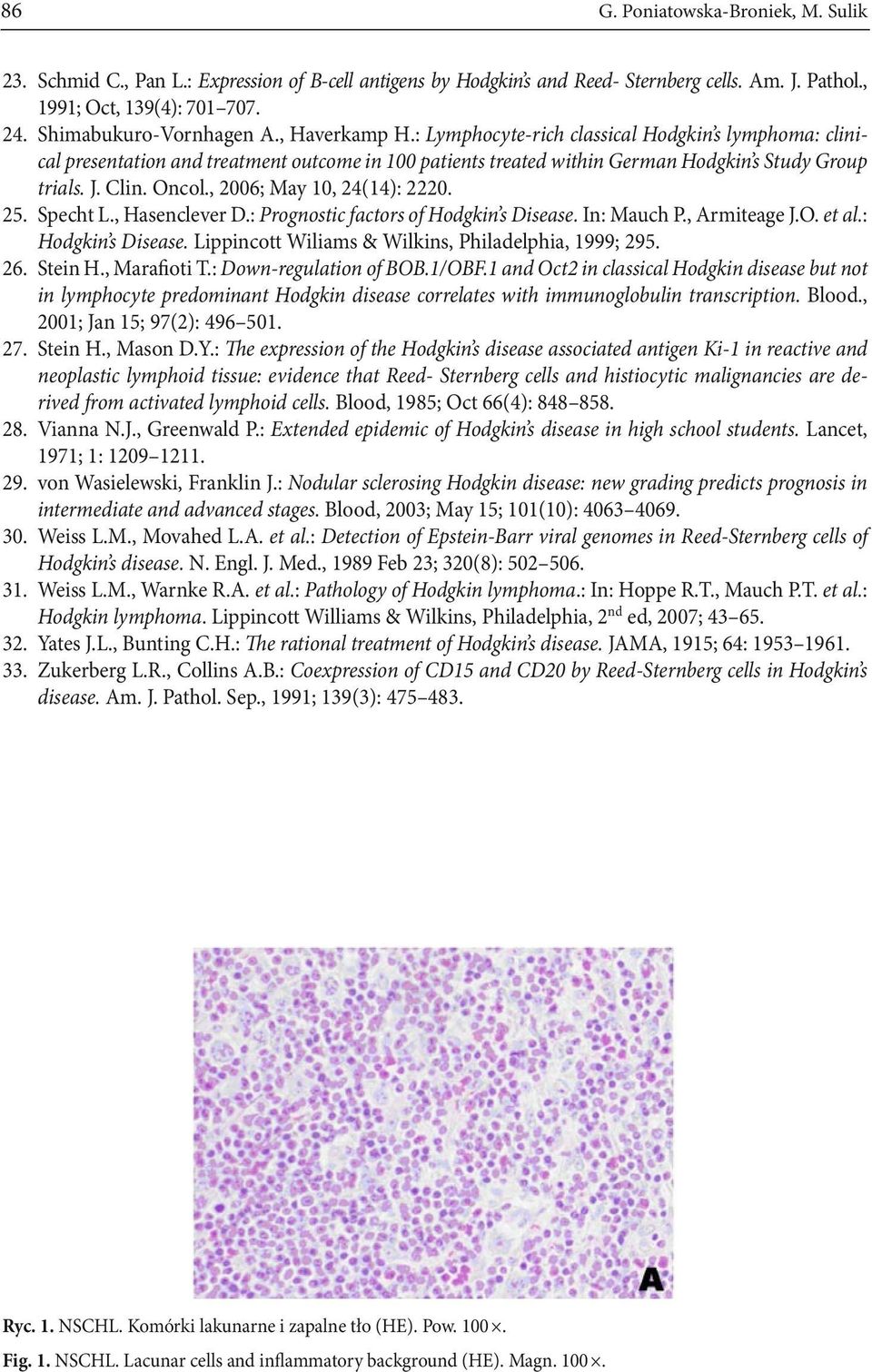 Clin. Oncol., 2006; May 10, 24(14): 2220. 25. Specht L., Hasenclever D.: Prognostic factors of Hodgkin s Disease. In: Mauch P., Armiteage J.O. et al.: Hodgkin s Disease.