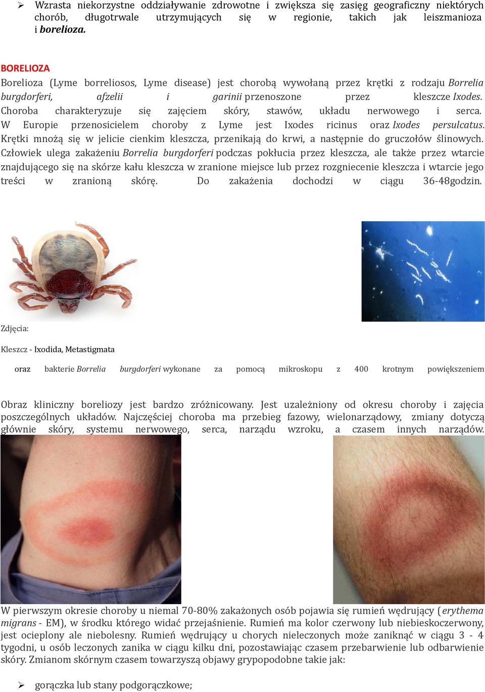 Choroba charakteryzuje się zajęciem skóry, stawów, układu nerwowego i serca. W Europie przenosicielem choroby z Lyme jest Ixodes ricinus oraz Ixodes persulcatus.