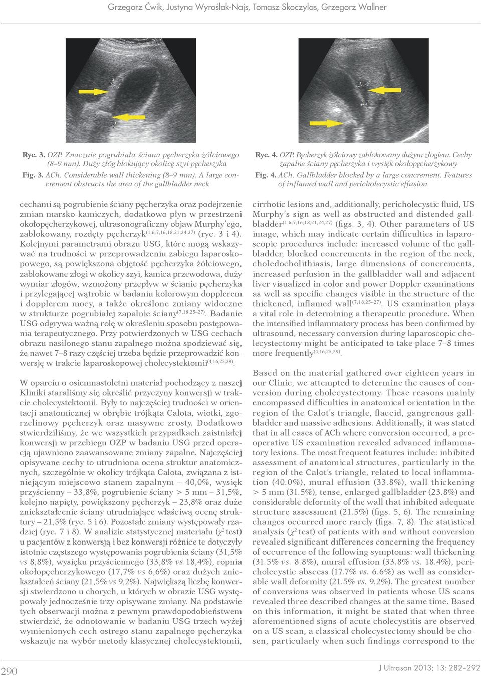 A large concrement obstructs the area of the gallbladder neck cechami są pogrubienie ściany pęcherzyka oraz podejrzenie zmian marsko-kamiczych, dodatkowo płyn w przestrzeni okołopęcherzykowej,