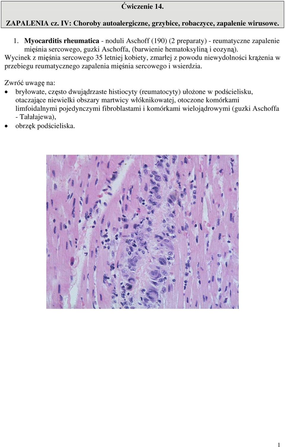 bryłowate, często dwujądrzaste histiocyty (reumatocyty) ułożone w podścielisku, otaczające niewielki obszary martwicy włóknikowatej, otoczone komórkami limfoidalnymi