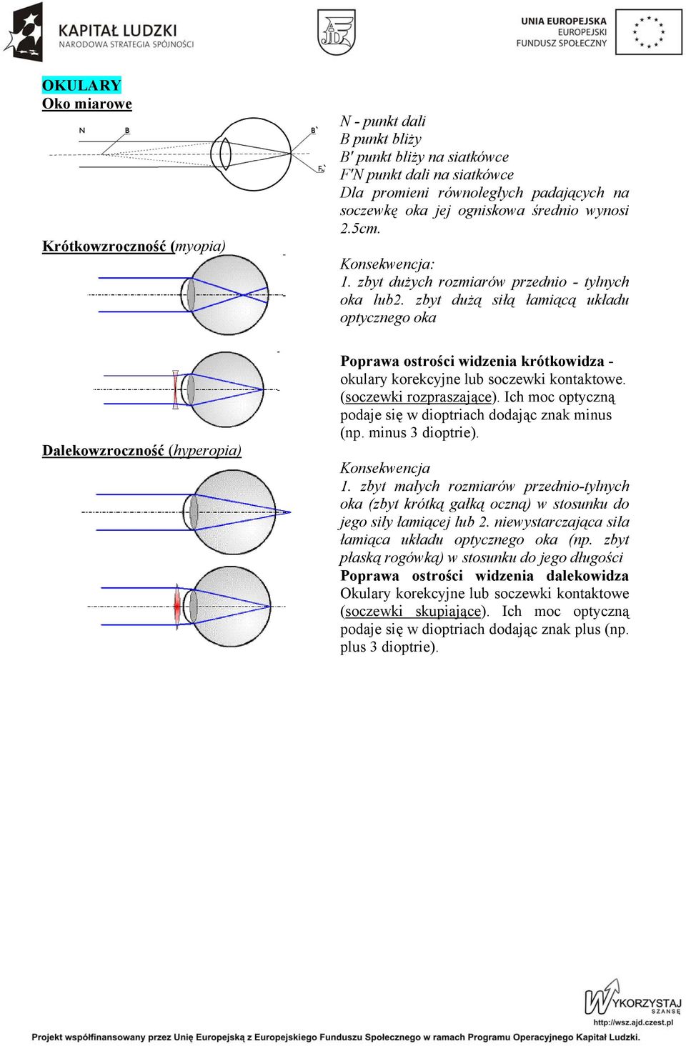 zbyt dużą siłą łamiącą układu optycznego oka Poprawa ostrości widzenia krótkowidza - okulary korekcyjne lub soczewki kontaktowe. (soczewki rozpraszające).