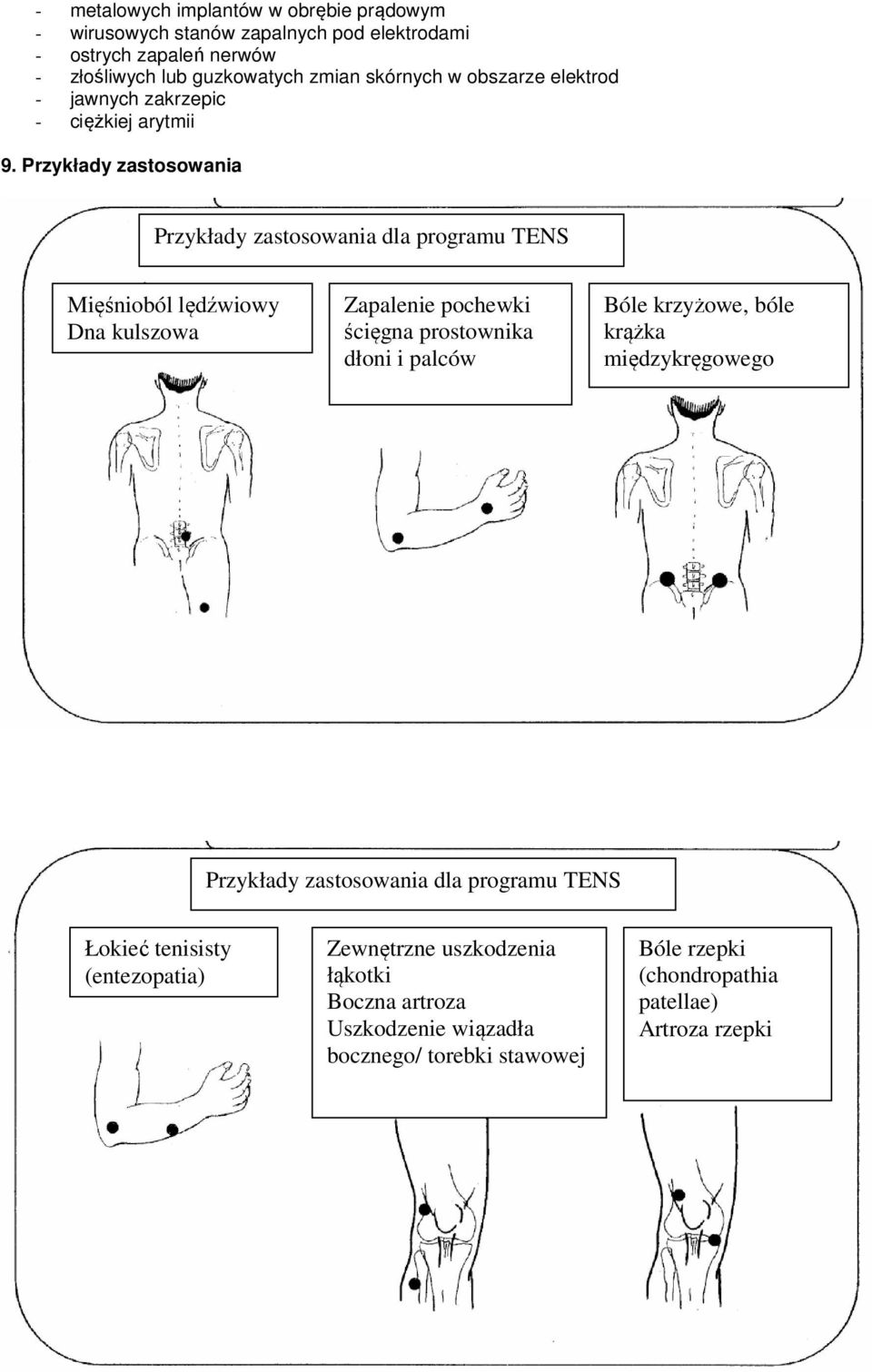 Przykłady zastosowania Przykłady zastosowania dla programu TENS Mięśnioból lędźwiowy Dna kulszowa Zapalenie pochewki ścięgna prostownika dłoni i palców Bóle