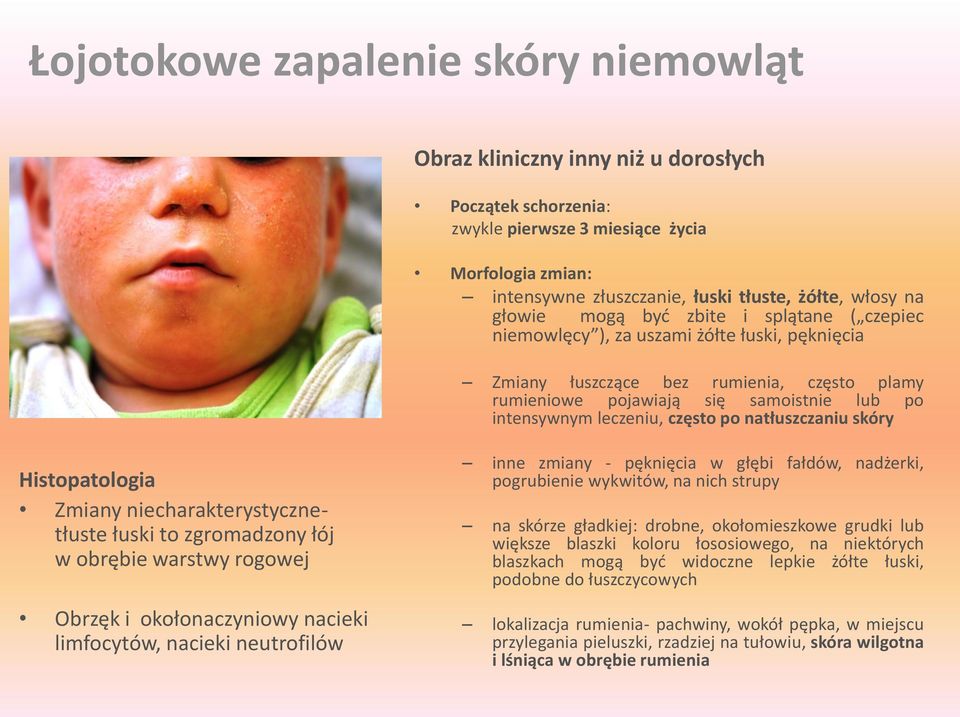 często po natłuszczaniu skóry Histopatologia Zmiany niecharakterystycznetłuste łuski to zgromadzony łój w obrębie warstwy rogowej Obrzęk i okołonaczyniowy nacieki limfocytów, nacieki neutrofilów inne