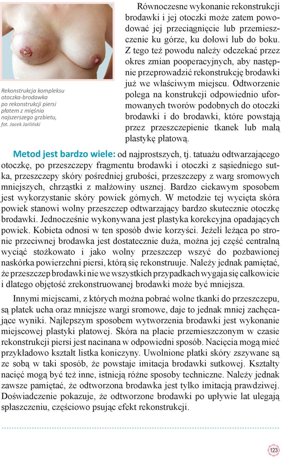 Z tego też powodu należy odczekać przez okres zmian pooperacyjnych, aby następnie przeprowadzić rekonstrukcję brodawki już we właściwym miejscu.