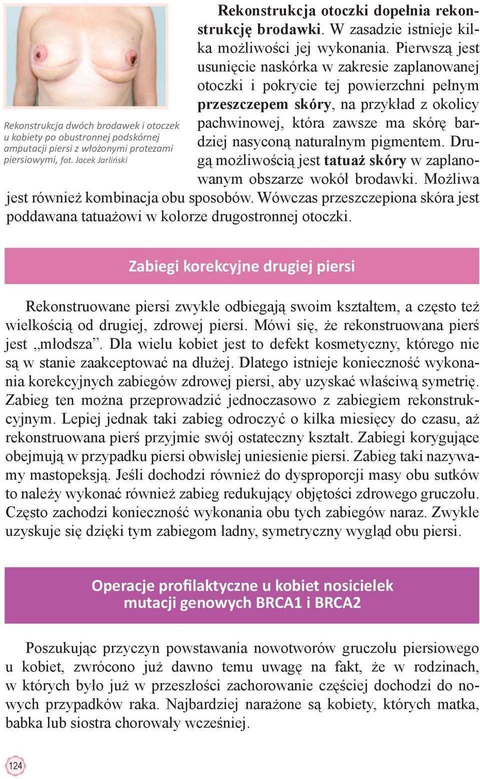 naturalnym pigmentem. Drugą możliwością jest tatuaż skóry w zaplanowanym obszarze wokół brodawki. Możliwa jest również kombinacja obu sposobów.