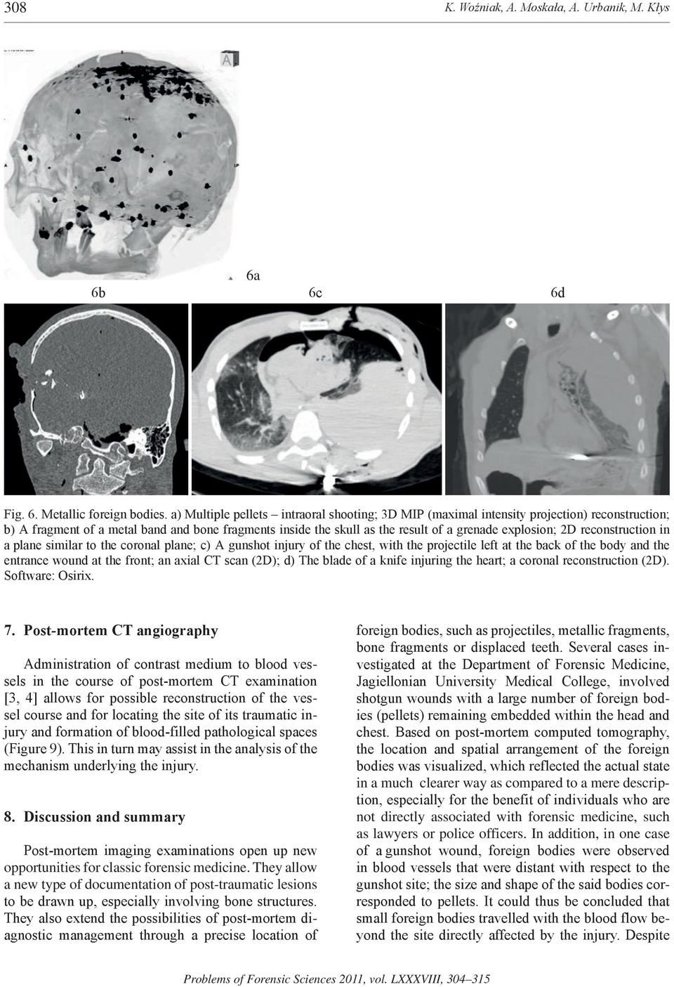 2D reconstruction in a plane similar to the coronal plane; c) A gunshot injury of the chest, with the projectile left at the back of the body and the entrance wound at the front; an axial CT scan