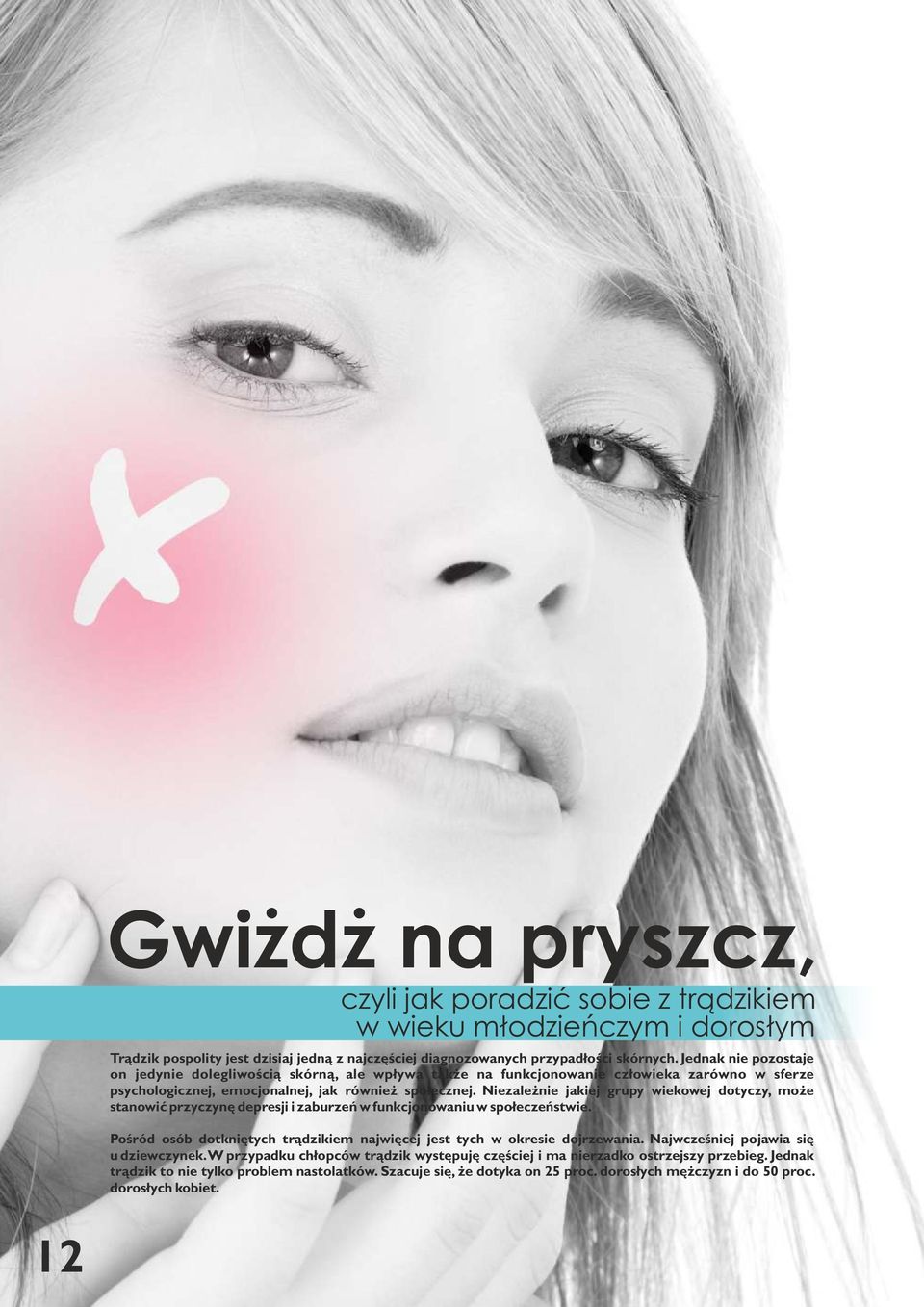 Niezależnie jakiej grupy wiekowej dotyczy, może stanowić przyczynę depresji i zaburzeń w funkcjonowaniu w społeczeństwie. Pośród osób dotkniętych trądzikiem najwięcej jest tych w okresie dojrzewania.