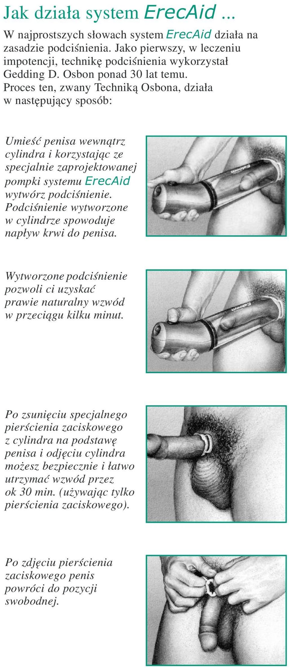 Proces ten, zwany Technik¹ Osbona, dzia³a w nastêpuj¹cy sposób: Umieœæ penisa wewn¹trz cylindra i korzystaj¹c ze specjalnie zaprojektowanej pompki systemu ErecAid wytwórz podciœnienie.