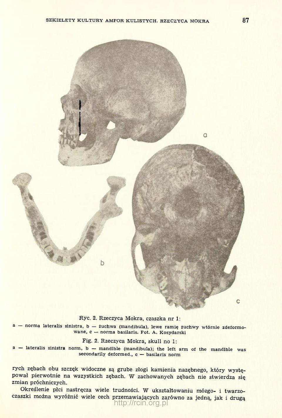 Rzeczyca Mokra, skull no 1: a lateralis sinistra norm, b mandible (mandibula); the left arm of the mandible was secondarily deformed.