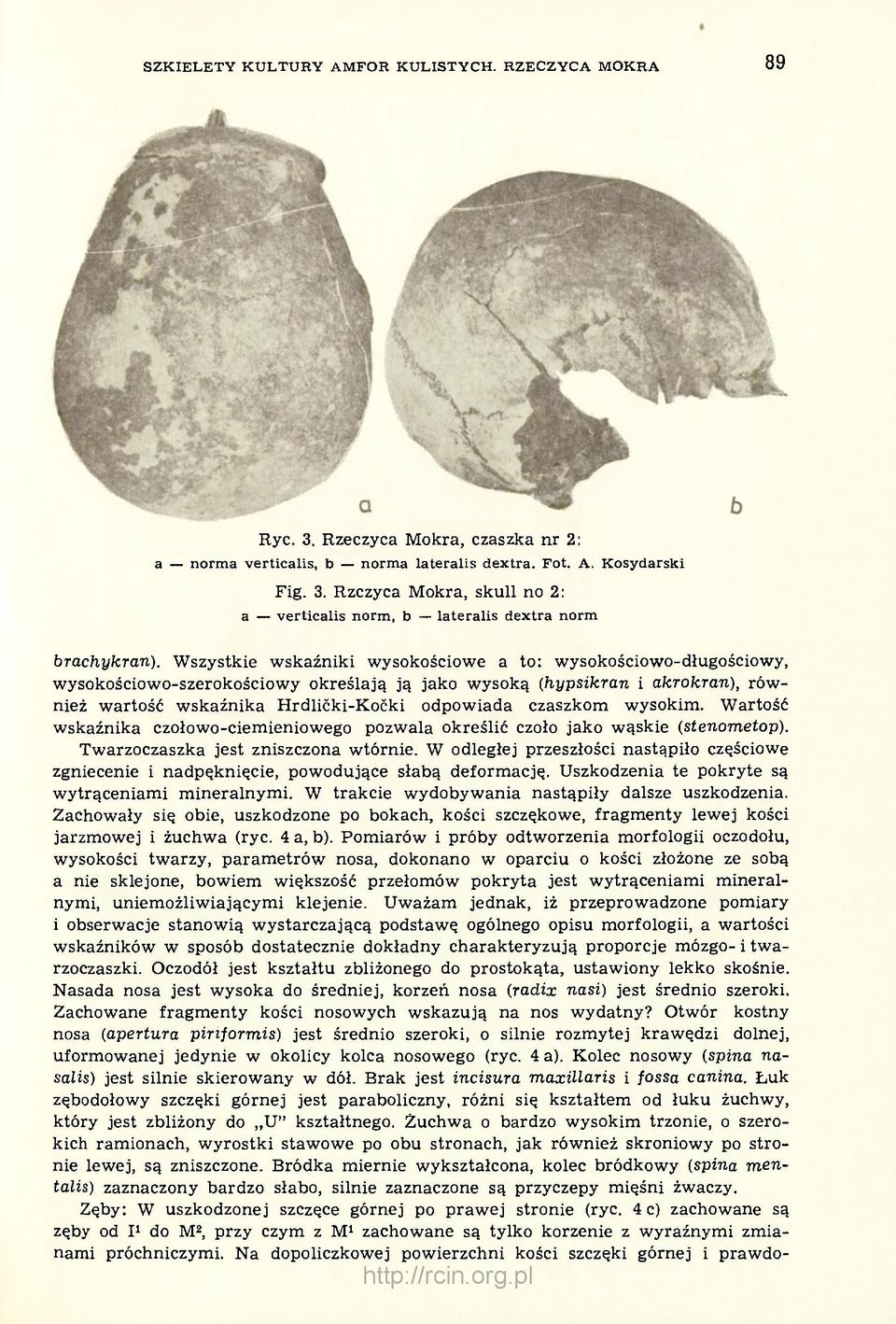 czaszkom wysokim. Wartość wskaźnika czołowo-ciemieniowego pozwala określić czoło jako wąskie (stenometop). Twarzoczaszka jest zniszczona wtórnie.