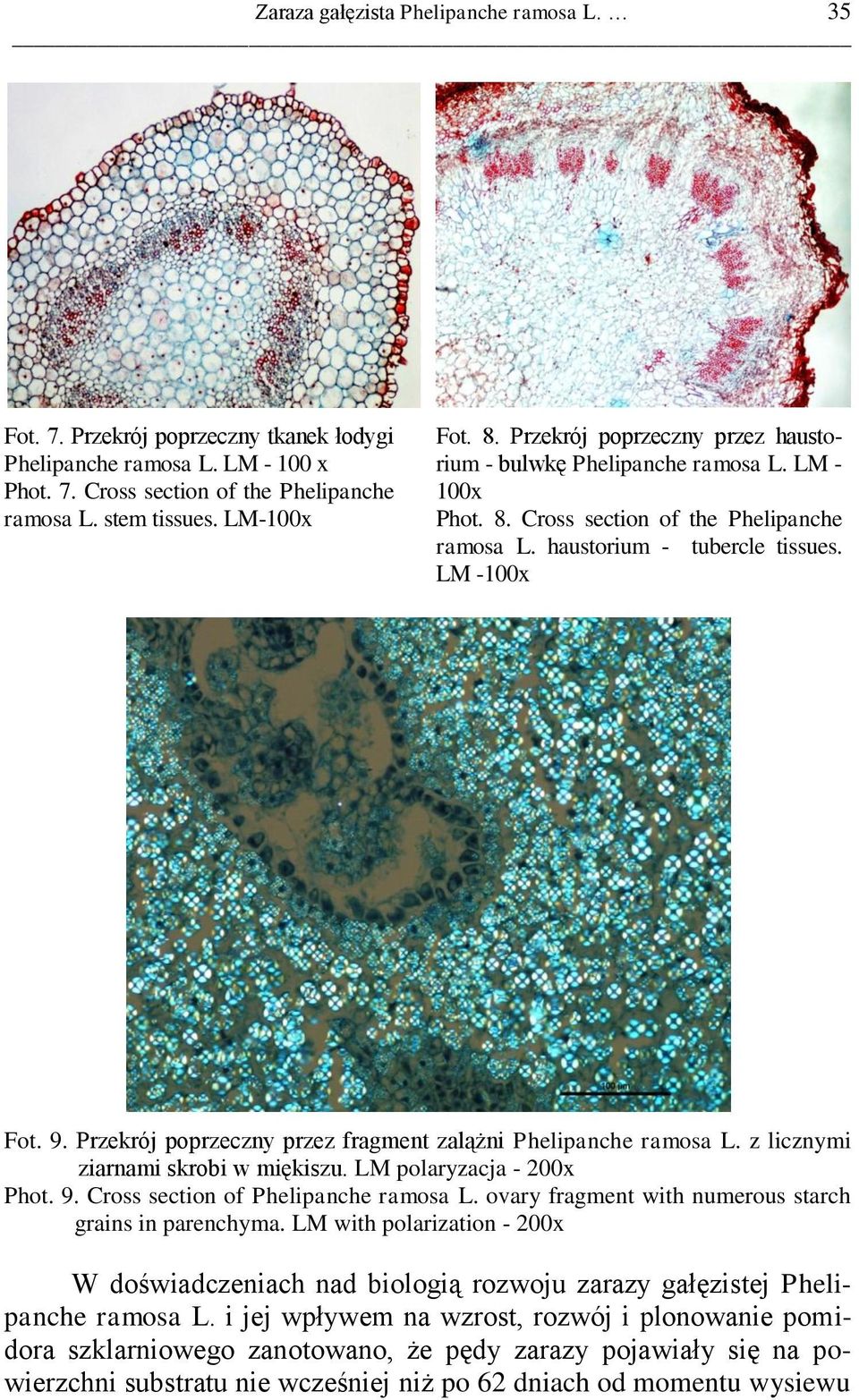 Przekrój poprzeczny przez fragment zalążni Phelipanche ramosa L. z licznymi ziarnami skrobi w miękiszu. LM polaryzacja - 200x Phot. 9. Cross section of Phelipanche ramosa L.