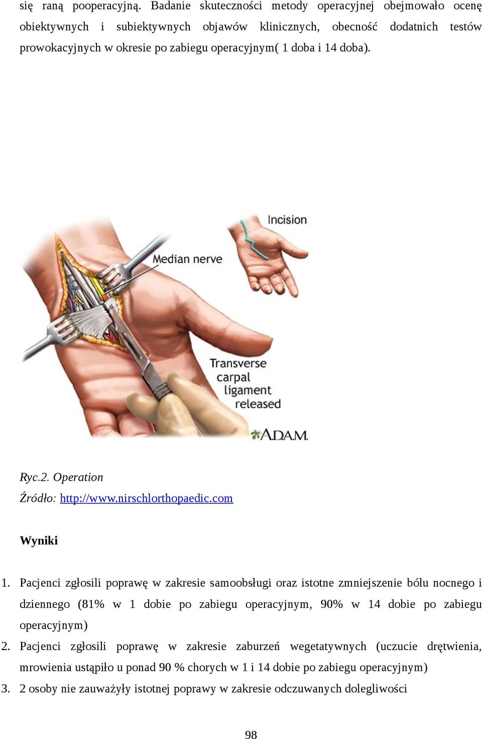 operacyjnym( 1 doba i 14 doba). Ryc.2. Operation Źródło: http://www.nirschlorthopaedic.com Wyniki 1.