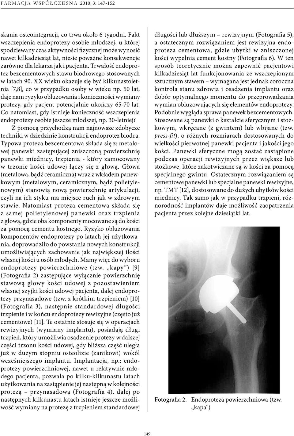 Trwałość endoprotez bezcementowych stawu biodrowego stosowanych w latach 90. XX wieku okazuje się być kilkunastoletnia [7,8], co w przypadku osoby w wieku np.