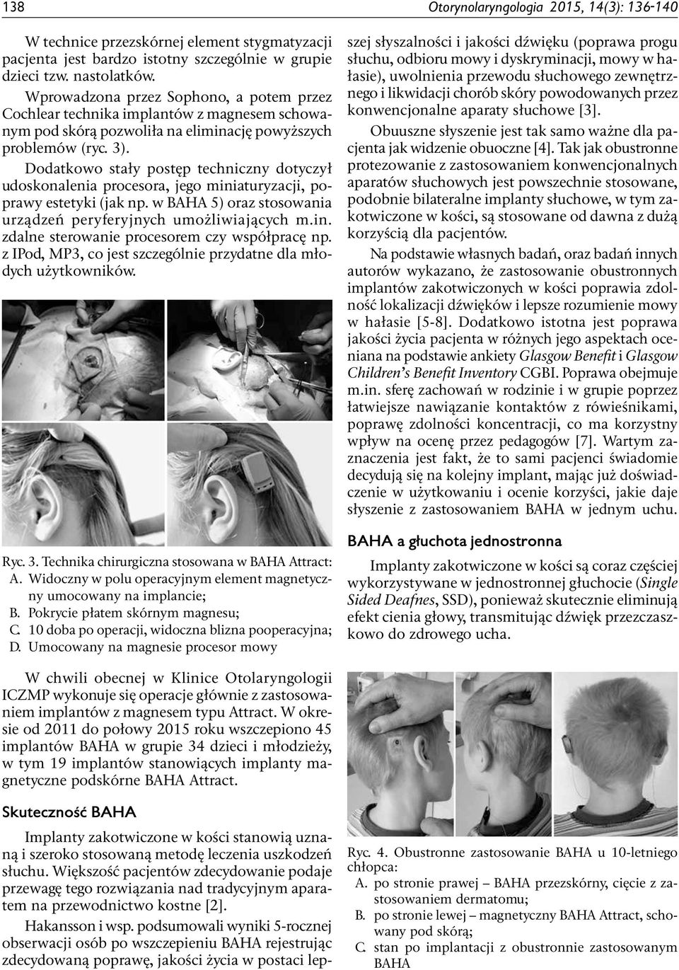 Dodatkowo stały postęp techniczny dotyczył udoskonalenia procesora, jego miniaturyzacji, poprawy estetyki (jak np. w BAHA 5) oraz stosowania urządzeń peryferyjnych umożliwiających m.in. zdalne sterowanie procesorem czy współpracę np.