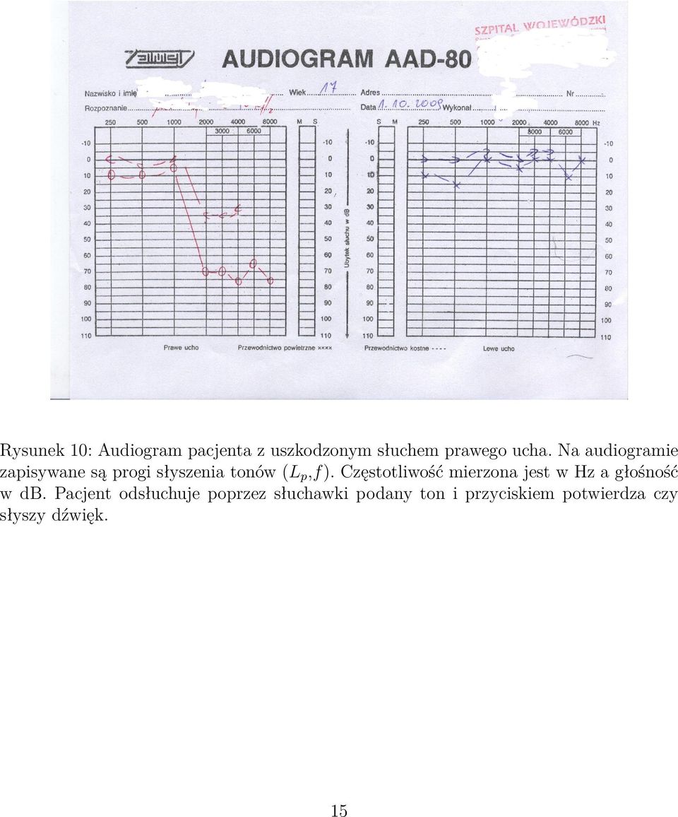 Częstotliwość mierzona jest w Hz a głośność w db.