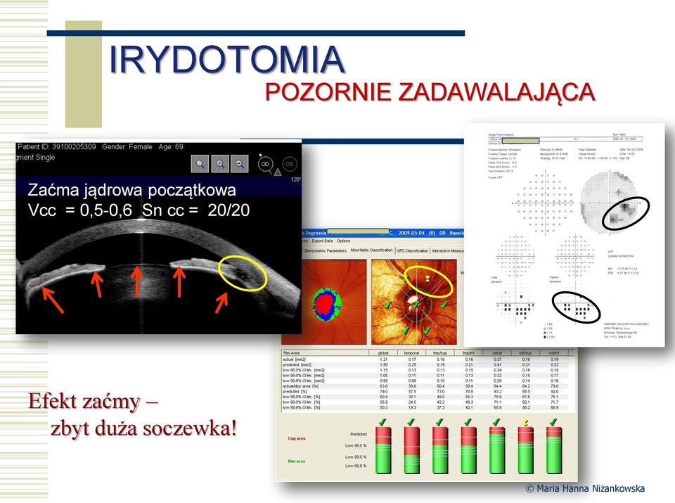 początkowa Vcc = 0,5-0,6 Sn