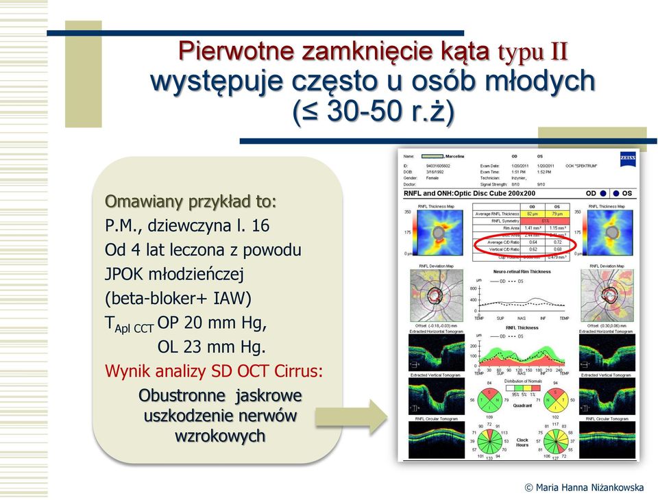 16 Od 4 lat leczona z powodu JPOK młodzieńczej (beta-bloker+ IAW) T Apl CCT