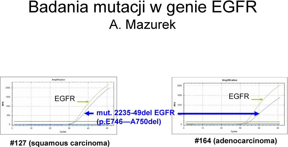 2235-49del EGFR (p.