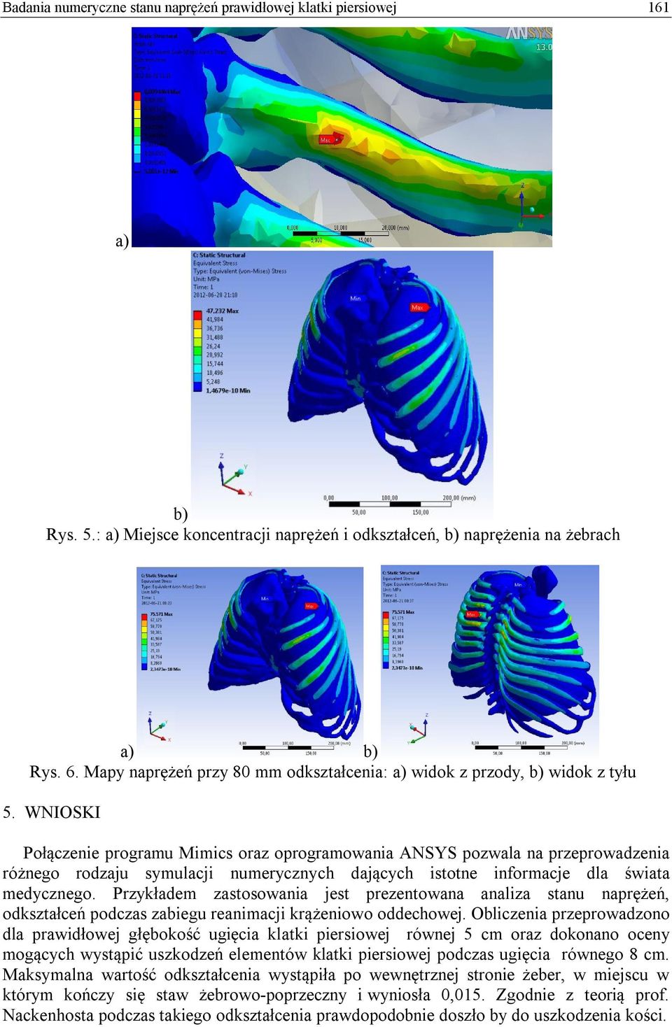 WNIOSKI Połączenie programu Mimics oraz oprogramowania ANSYS pozwala na przeprowadzenia różnego rodzaju symulacji numerycznych dających istotne informacje dla świata medycznego.