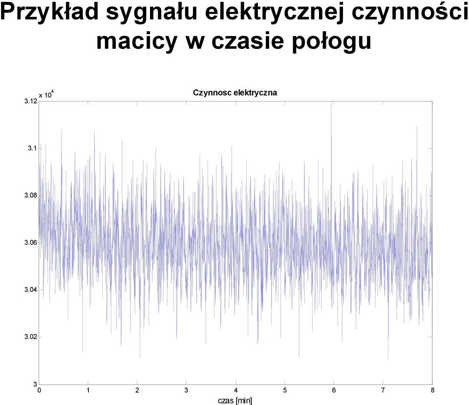 12 x 104 Czynnosc elektryczna 3.1 3.