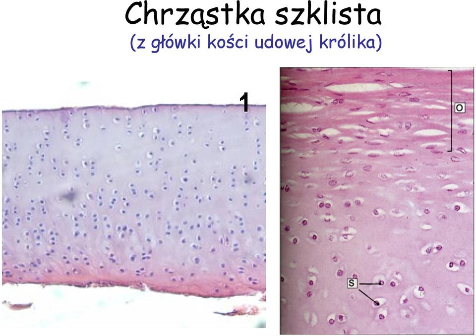 główki kości