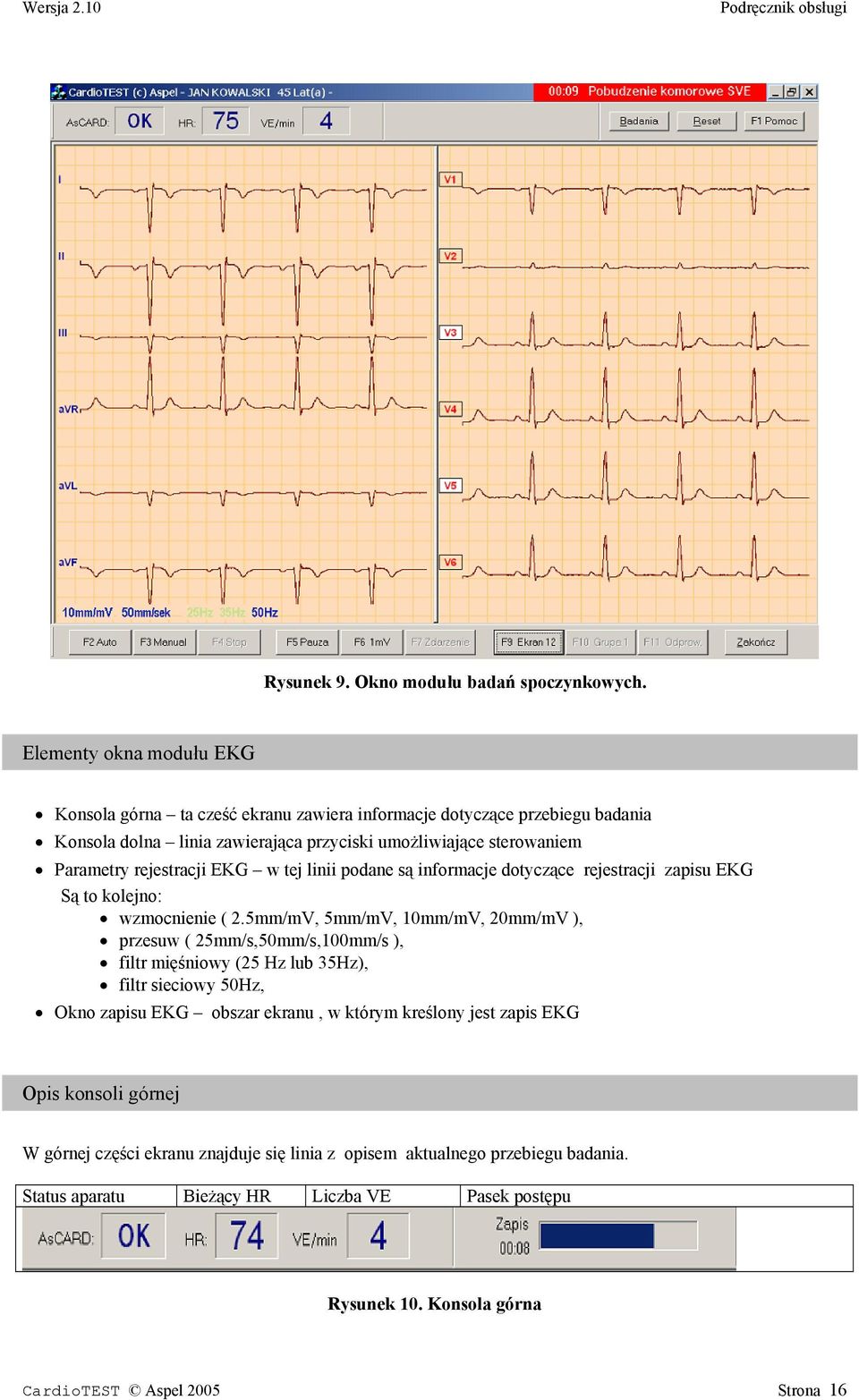 rejestracji EKG w tej linii podane są informacje dotyczące rejestracji zapisu EKG Są to kolejno: wzmocnienie ( 2.