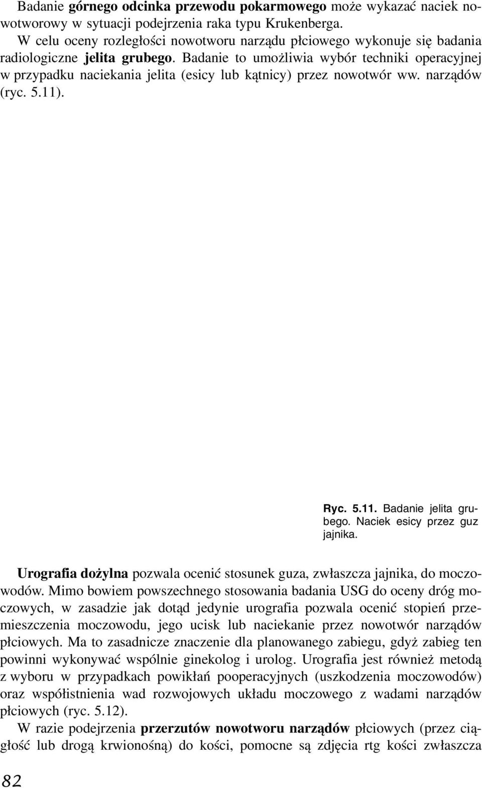 Badanie to umożliwia wybór techniki operacyjnej w przypadku naciekania jelita (esicy lub kątnicy) przez nowotwór ww. narządów (ryc. 5.11). Ryc. 5.11. Badanie jelita grubego.