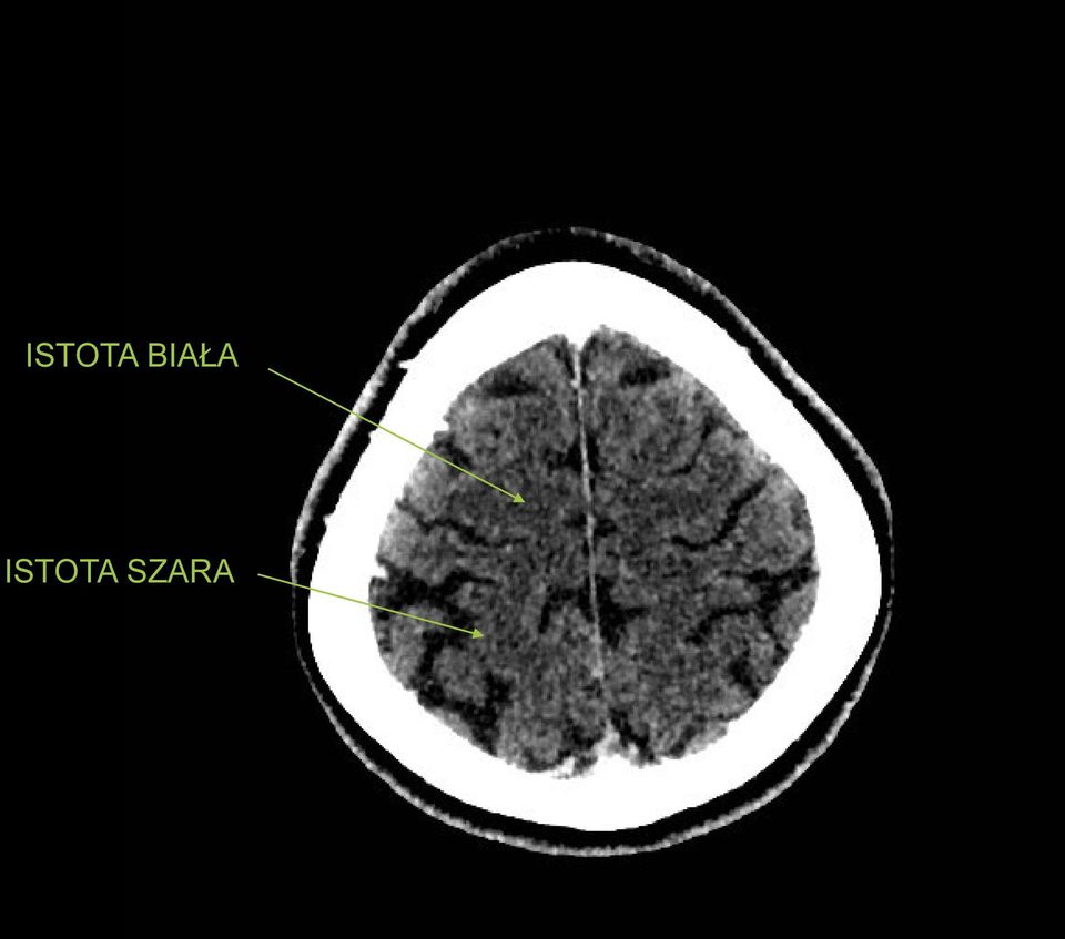 SZARA