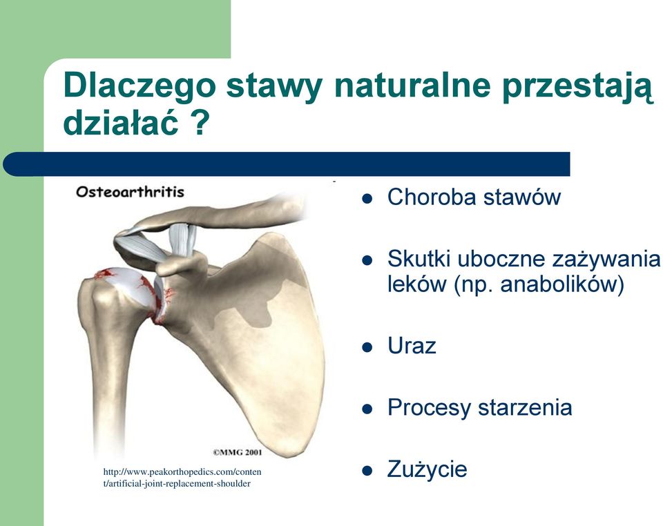 anabolików) Uraz Procesy starzenia http://www.