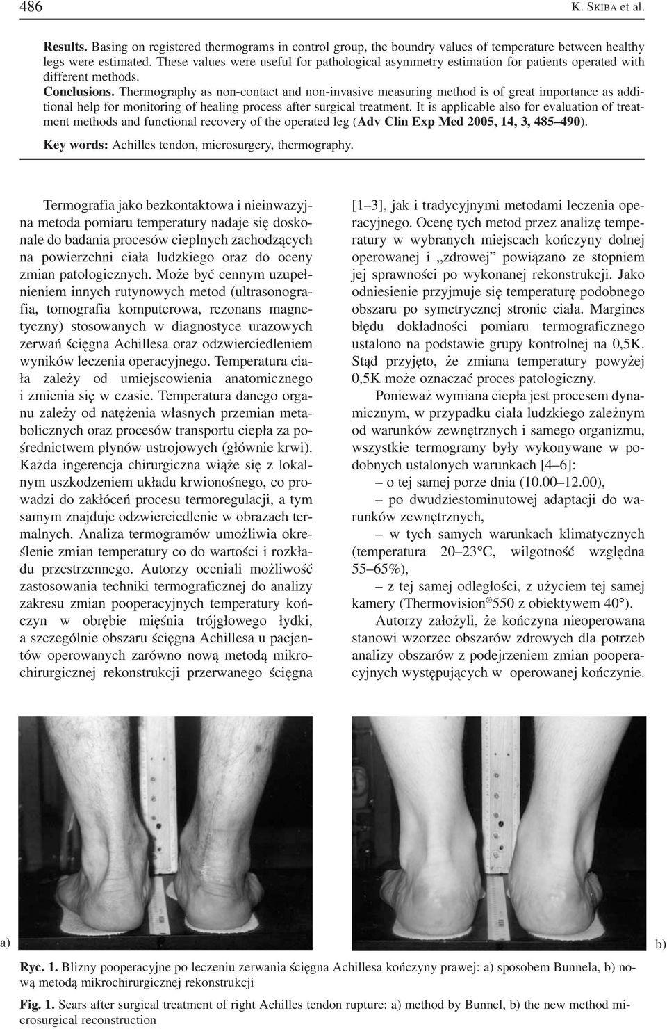 Thermography as non contact and non invasive measuring method is of great importance as addi tional help for monitoring of healing process after surgical treatment.