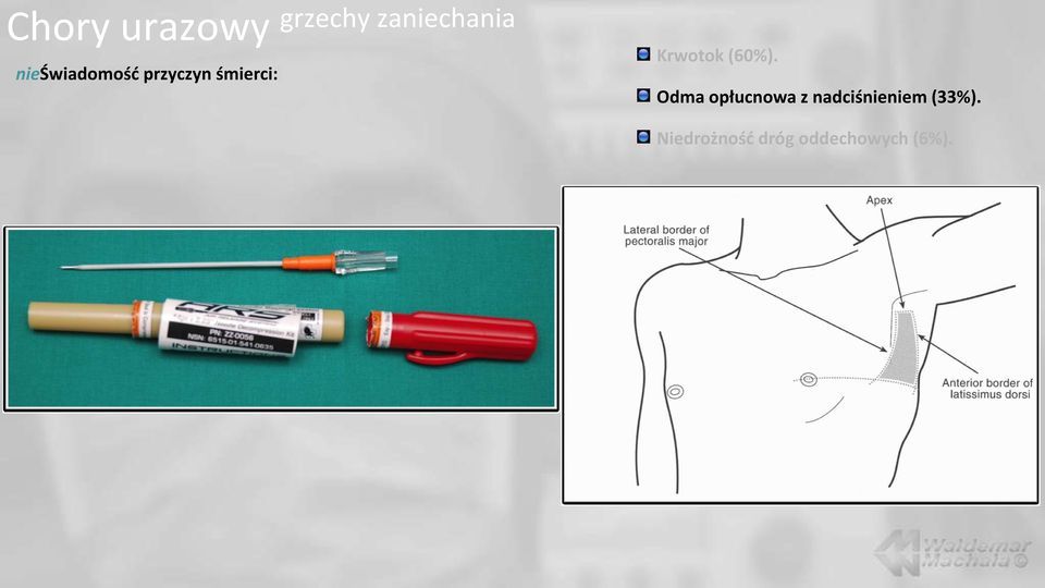 śmierci: Odma opłucnowa z