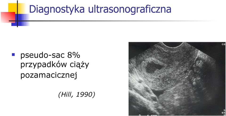 pseudo-sac 8%