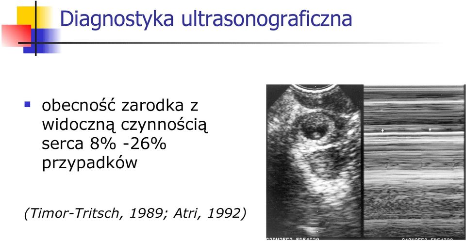 czynnością serca 8% -26%