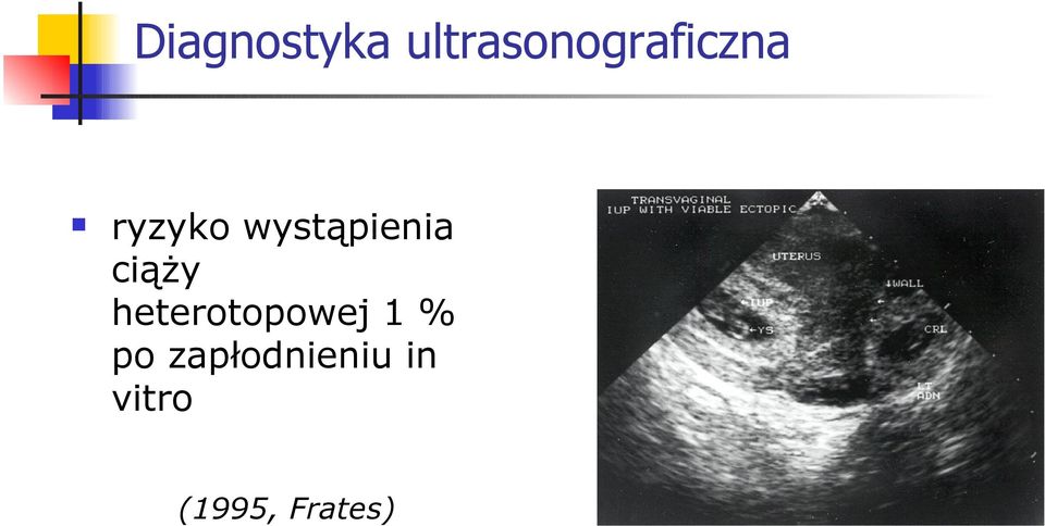 wystąpienia ciąży