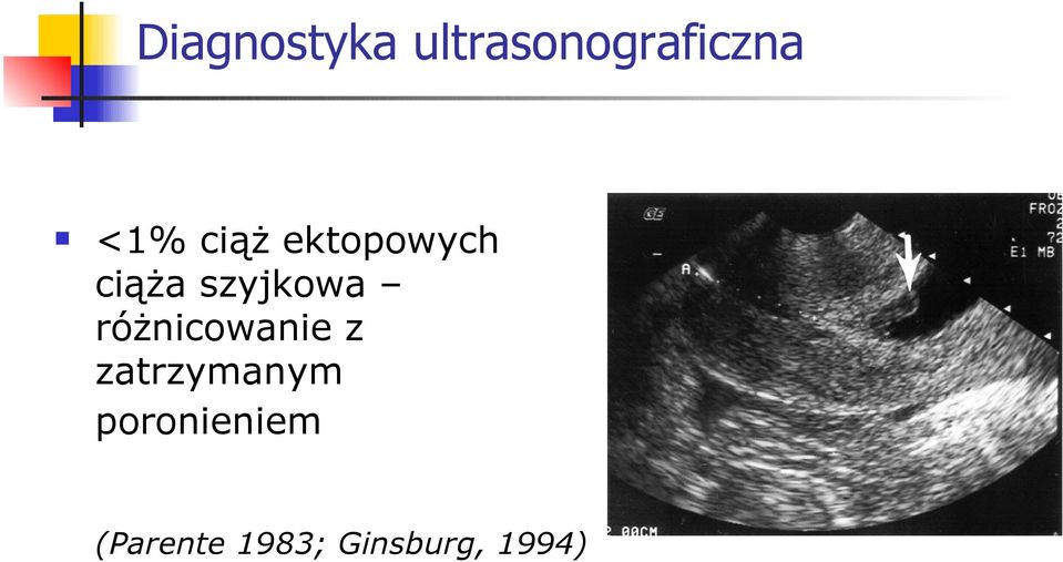 szyjkowa różnicowanie z