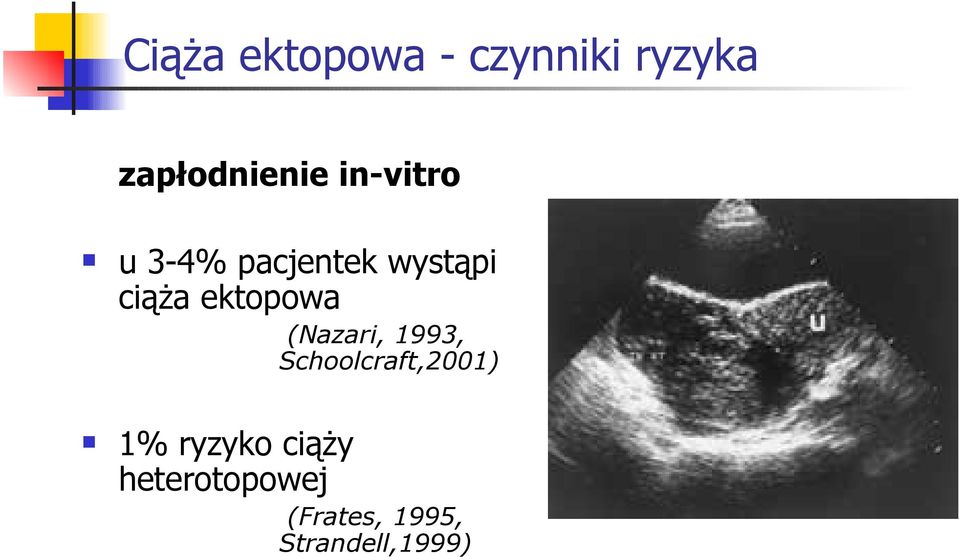 ektopowa (Nazari, 1993, Schoolcraft,2001) 1%