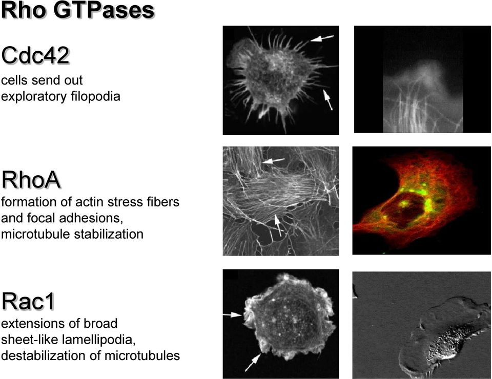 adhesions, microtubule stabilization Rac1 extensions of