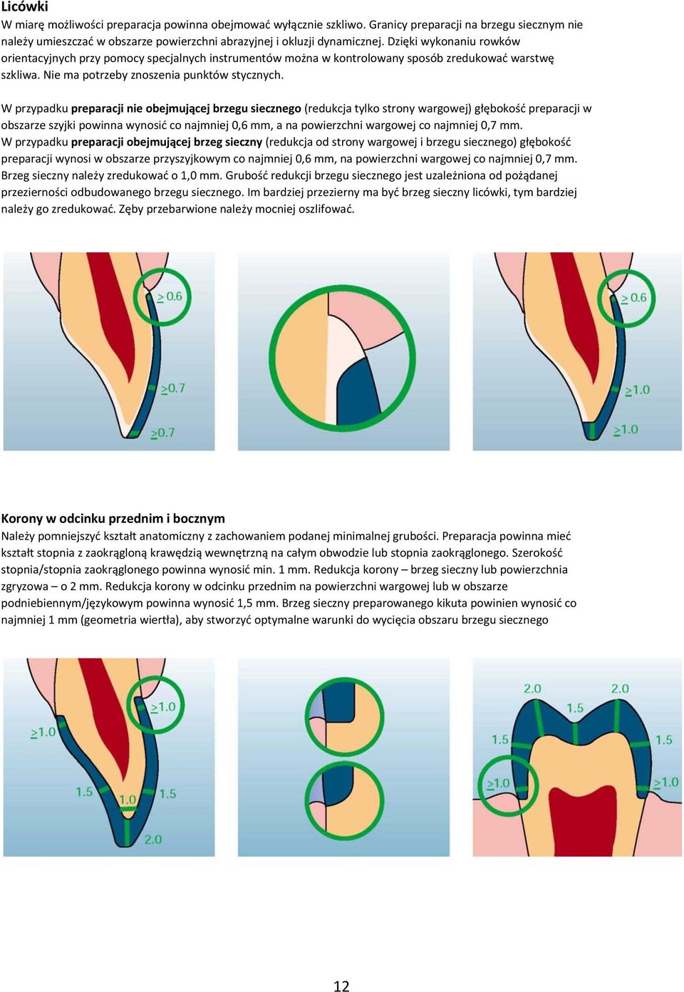 W przypadku preparacji nie obejmującej brzegu siecznego (redukcja tylko strony wargowej) głębokość preparacji w obszarze szyjki powinna wynosić co najmniej 0,6 mm, a na powierzchni wargowej co