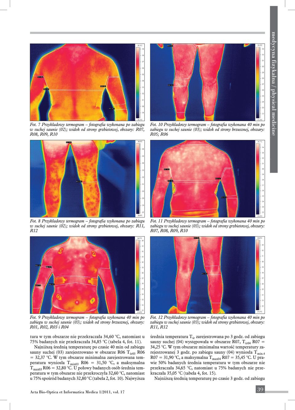 medicine engineering Fot. 8 Przykładowy termogram fotografia wykonana po zabiegu w suchej saunie (02); widok od strony grzbietowej, obszary: R11, R12 Fot.