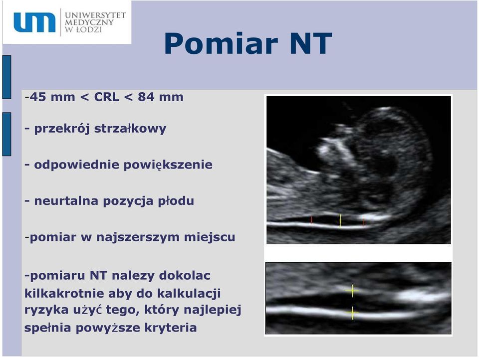 najszerszym miejscu -pomiaru NT nalezy dokolac kilkakrotnie aby