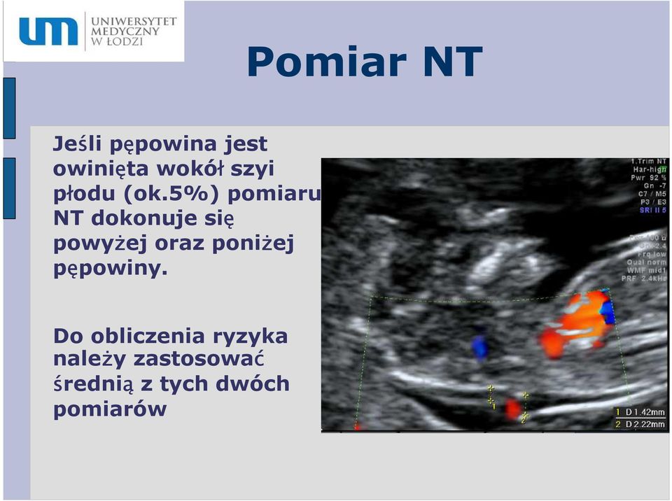 5%) pomiaru NT dokonuje się powyżej oraz