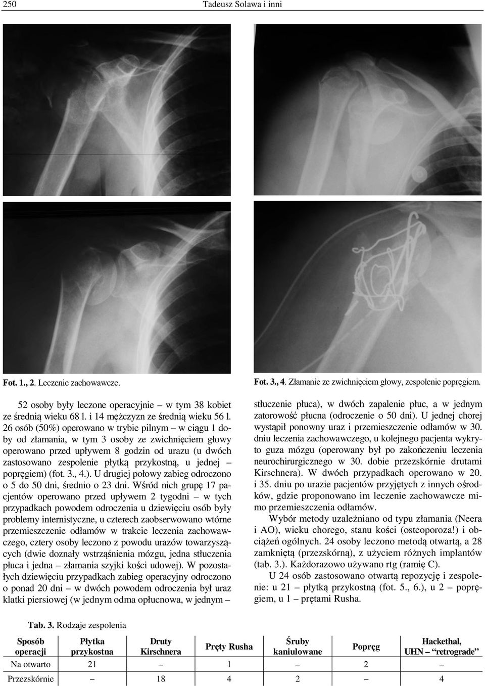 26 osób (50%) operowano w trybie pilnym w ciągu 1 doby od złamania, w tym 3 osoby ze zwichnięciem głowy operowano przed upływem 8 godzin od urazu (u dwóch zastosowano zespolenie płytką przykostną, u