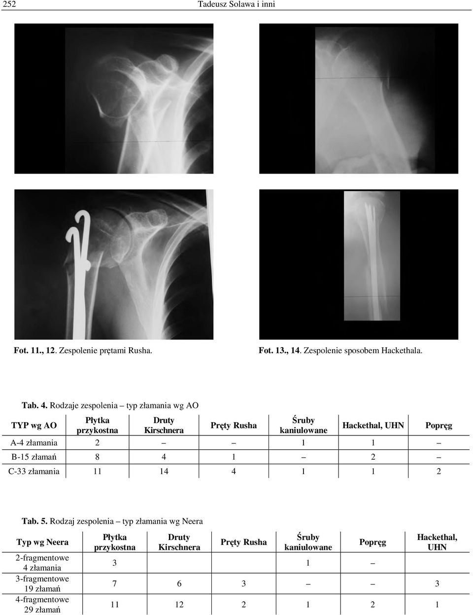 2 1 1 B-15 złamań 8 4 1 2 C-33 złamania 11 14 4 1 1 2 Popręg Tab. 5.