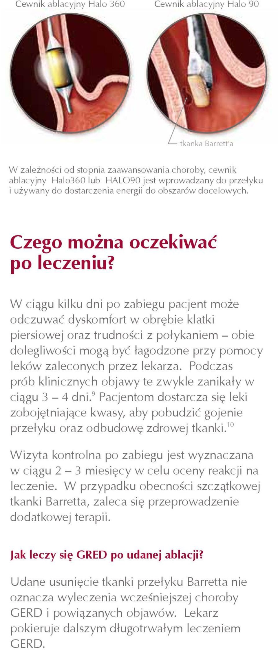 W ciągu kilku dni po zabiegu pacjent może odczuwać dyskomfort w obrębie klatki piersiowej oraz trudności z połykaniem obie dolegliwości mogą być łagodzone przy pomocy leków zaleconych przez lekarza.